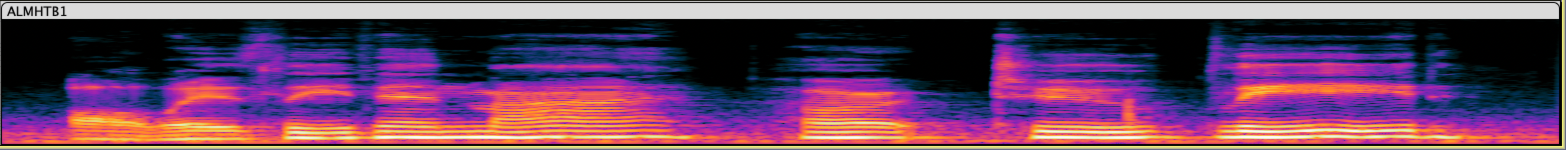 Spectrogram